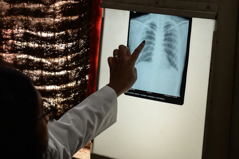 A doctor checks a chest X-ray.