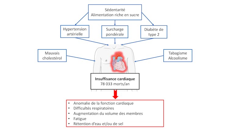 Schéma récapitulant les facteurs derrière une insuffisance cardiaque : diabète, sédentarité, etc