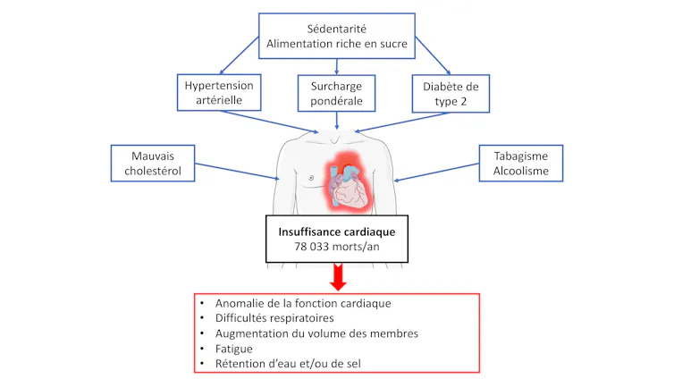 Schéma récapitulant les facteurs derrière une insuffisance cardiaque : diabète, sédentarité, etc