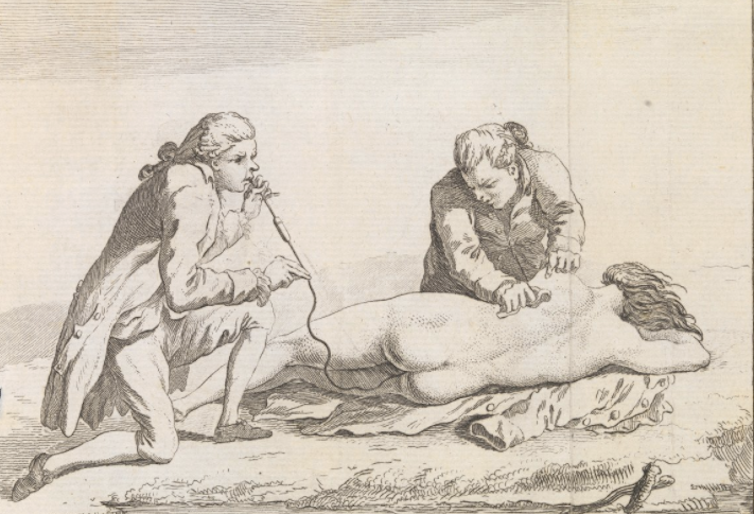 Plate illustrating the resuscitation of a drowned woman.