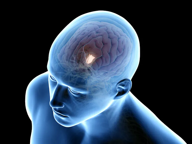 Image showing the the location of the hypothalamus in the brain.
