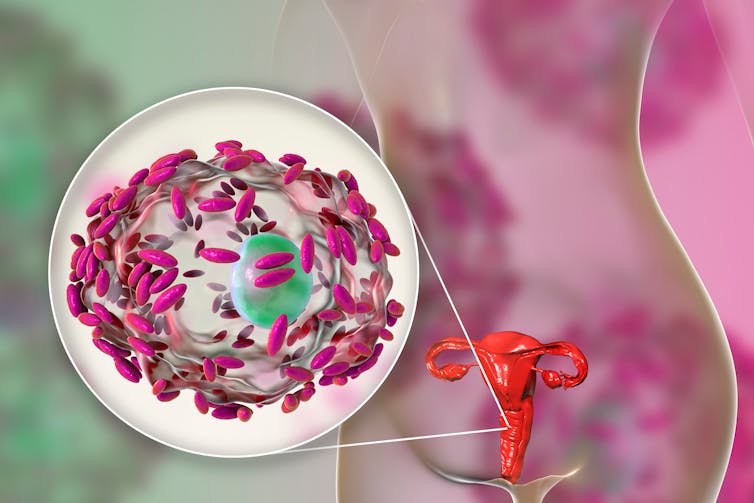 bacteria diagram plus female figure