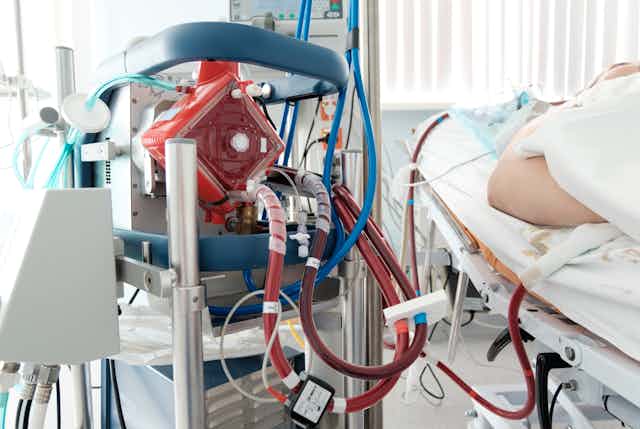 medical machine pumping blood by bedside