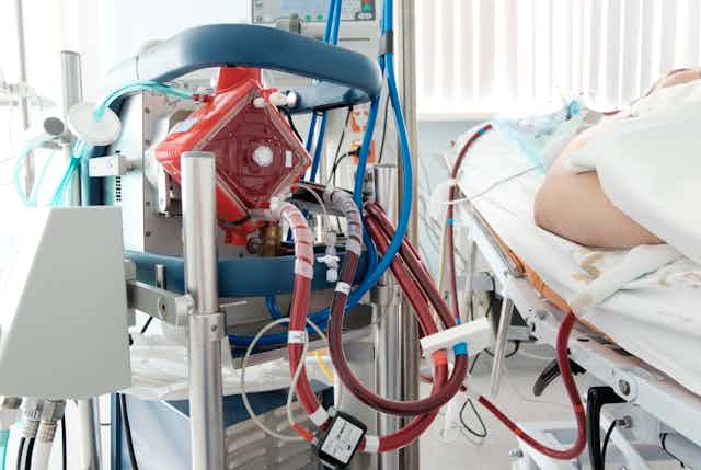 Complex Icu Patient 640*429 What is ECMO? Doctors are shocked so many ICU patients are on this ...