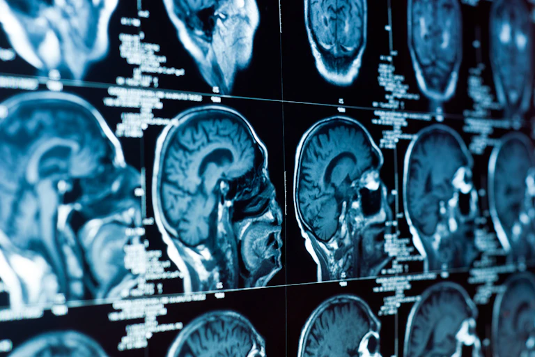Brain imaging.