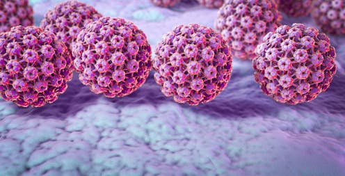 Some cancers are preventable with a vaccine – a virologist explains