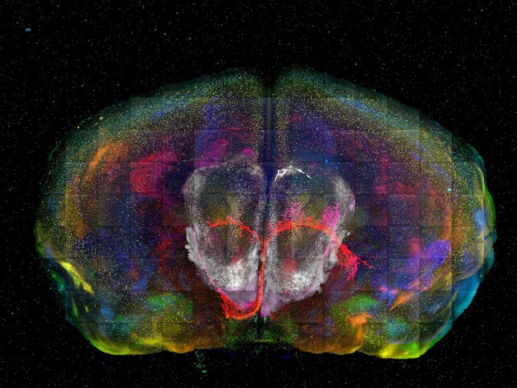 Stiched high-resolution microscopy image of mouse brain.