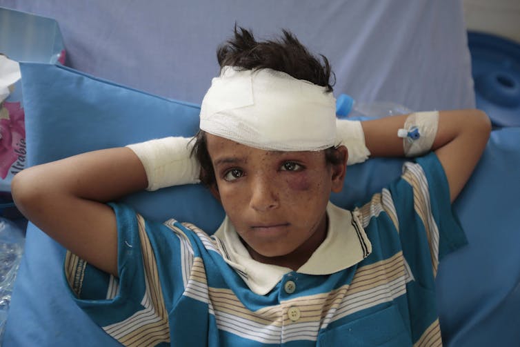 A young boy in a striped T-shirt with a bandage on his head and wrists and wounds on his face stares at the camera.