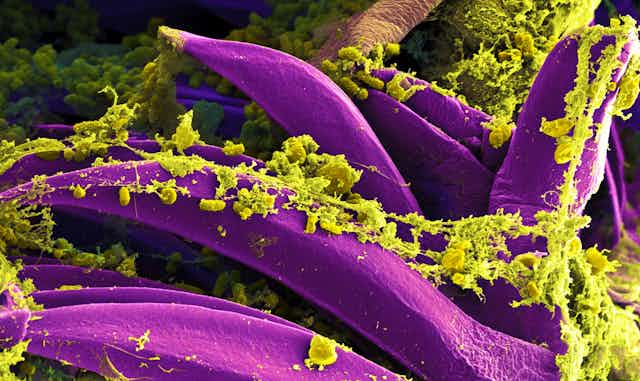 Micrographie électronique de bactéries responsables de la peste bubonique (Yersina pestis, en jaune, fausses couleurs) proliférant dans le tube digestif d’un rat.