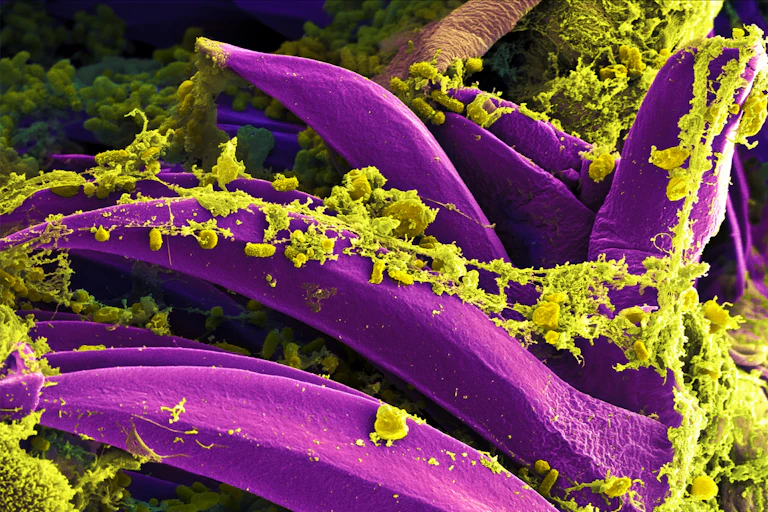 Micrographie électronique de bactéries responsables de la peste bubonique (Yersina pestis, en jaune, fausses couleurs) proliférant dans le tube digestif d’un rat.