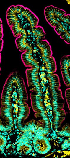 Micrograph of mouse intestinal villi.