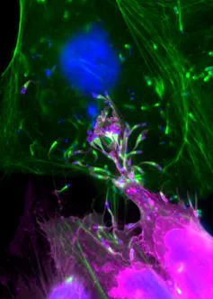 Electron microscope image of HeLa cells infected with Listeria monocytogenes.