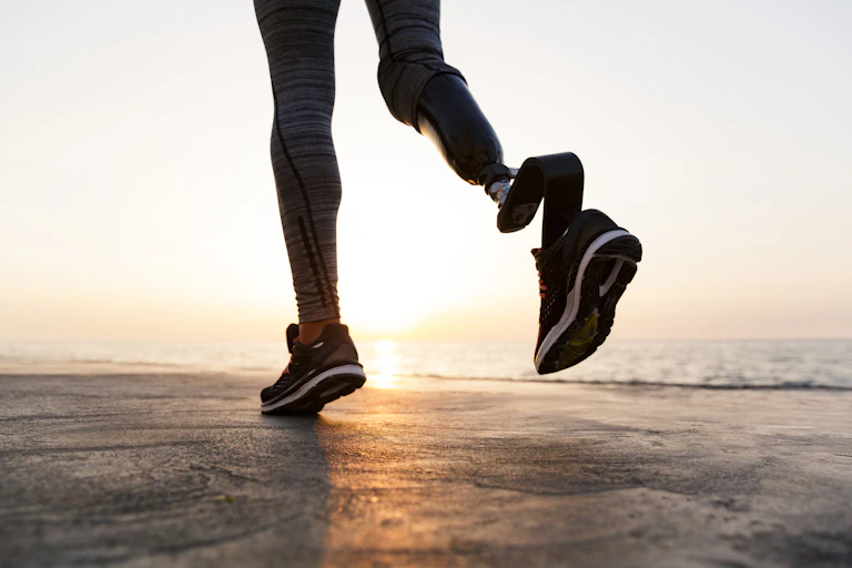 A woman running with a prosthetic leg