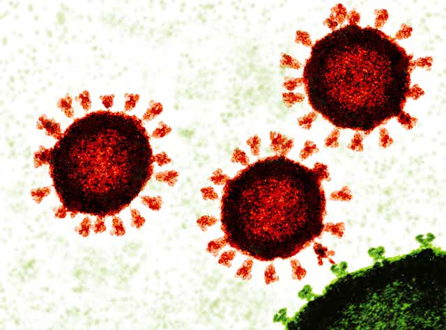 Three red coronavirus particles next to a green human cell.