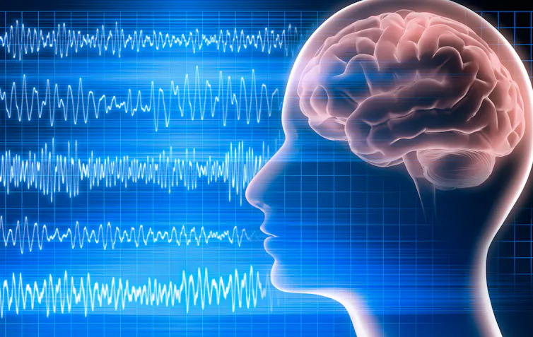 A brain with waves next to it