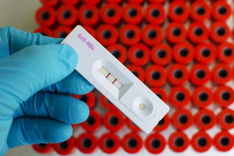 Blue gloves holding a test for hepatitis