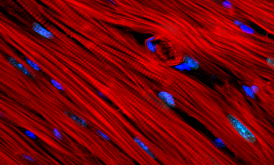 Close-up microscope image of red-tinted heart tissue with nuclei colored blue. 