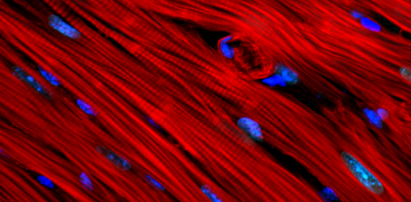 Mechanical forces in a beating heart affect its cells' DNA, with implications for development and disease