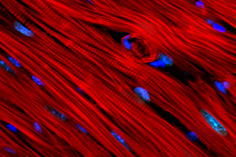 Close-up microscope image of red-tinted heart tissue with nuclei colored blue.