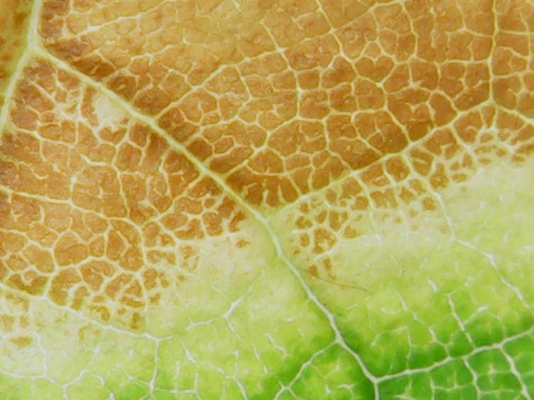 Microscope image of leaf