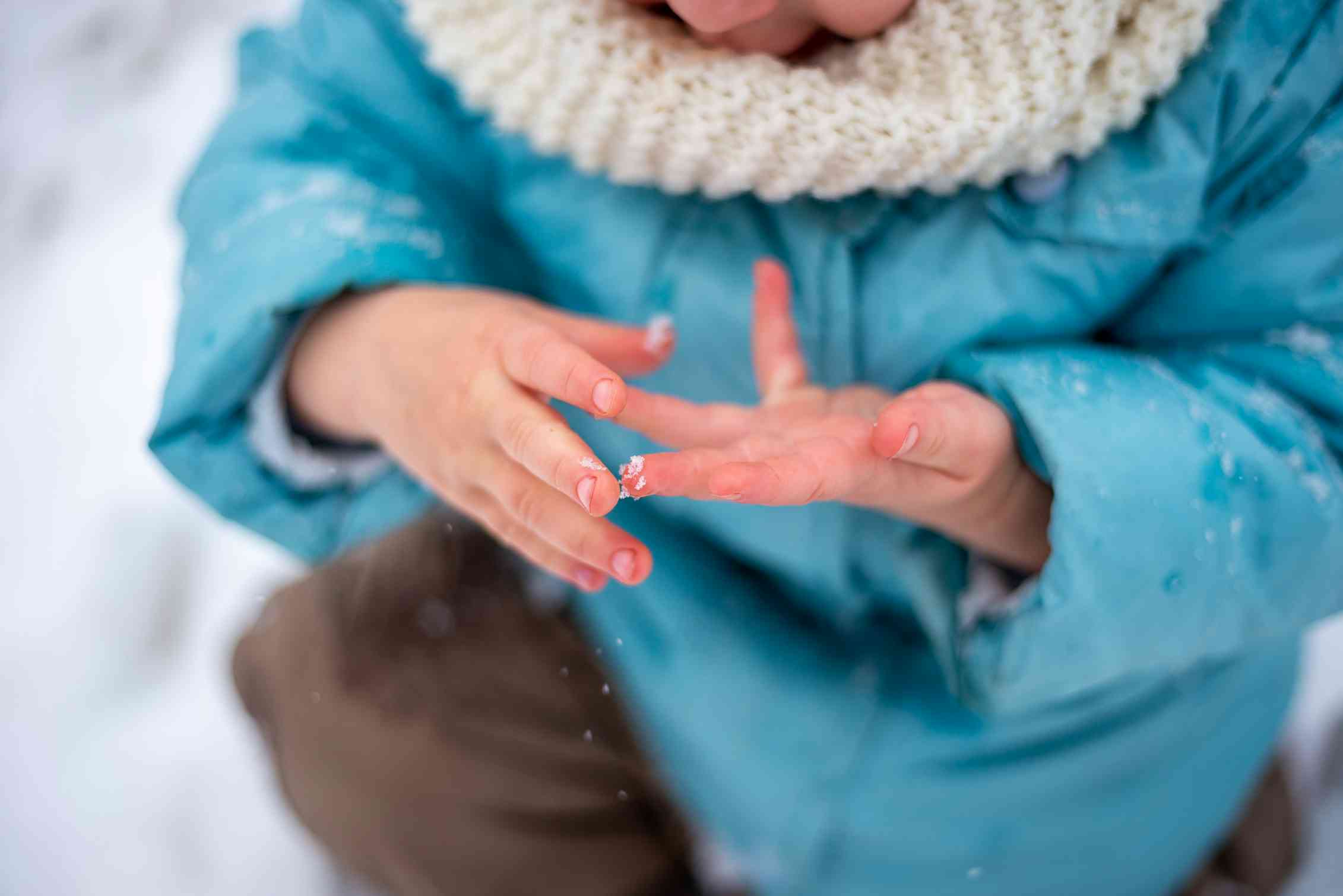 a young child with bare hands and reddened fingertips in the snow