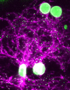 Image of magenta-colored neurons in a live fish brain, with the synapses colored in green