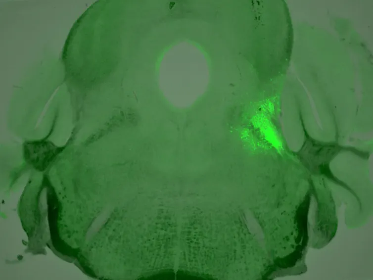 Scan of mouse brain colored green, with the lateral parabrachial nucleus highlighted to the middle right.