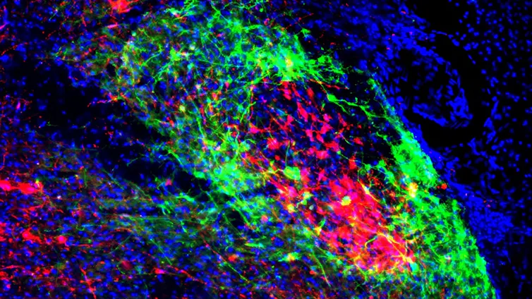 Image showing mu-opioid receptor expressing shell neurons in green and core neurons in red.