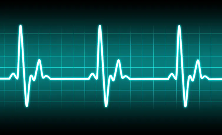 Digital image of a heartbeat, as shown on an electrocardiogram (ECG).