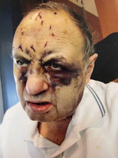 An elderly man with severe injuries, including cut marks and bruises, across his face and forehead.