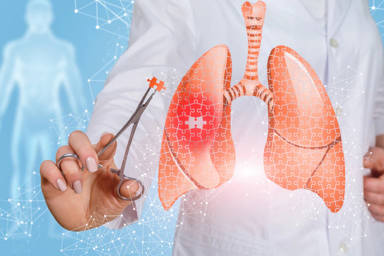 Illustration of lungs with a jigsaw pattern, and a person in a white coat holding a puzzle piece in medical forceps