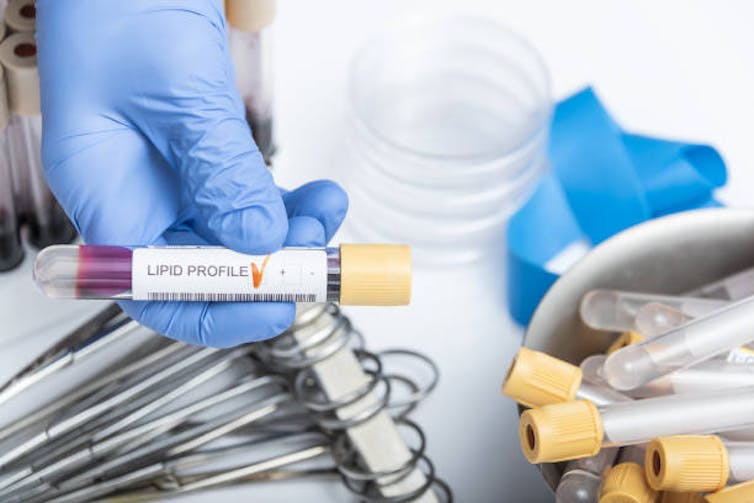 Blue-gloved hand holding clear vial of blood.