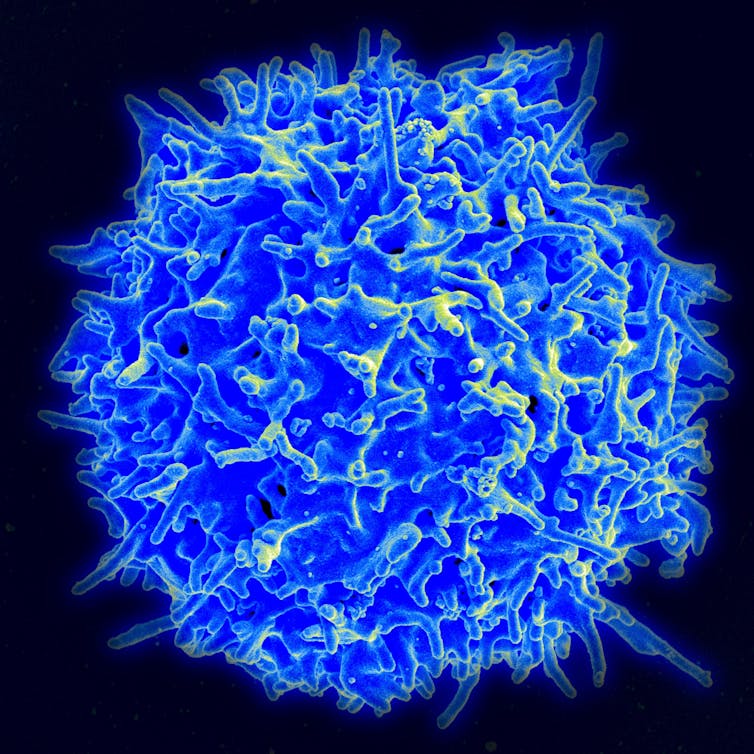 تصویری از میکروسکوپ الکترونی روبشی از یک توپ آبی توده ای از یک سلول T.
