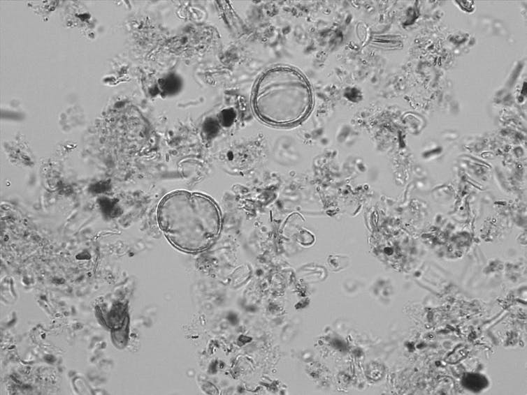 Black and white magnified image of pollen.