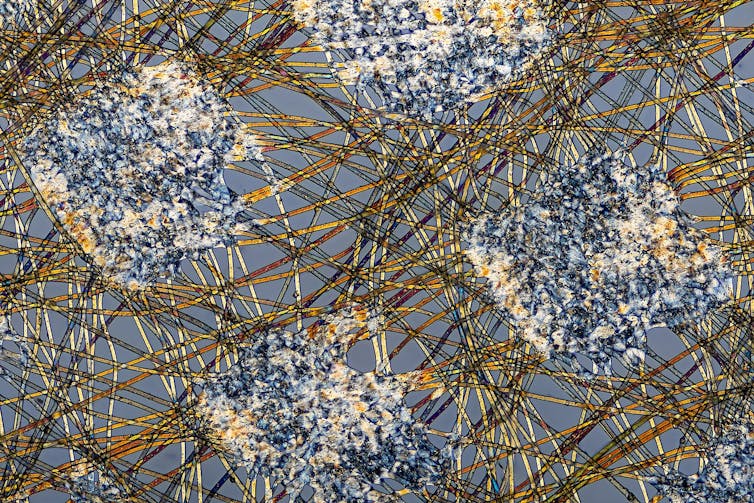 A mass of tangled fibers, seen under a microscope.