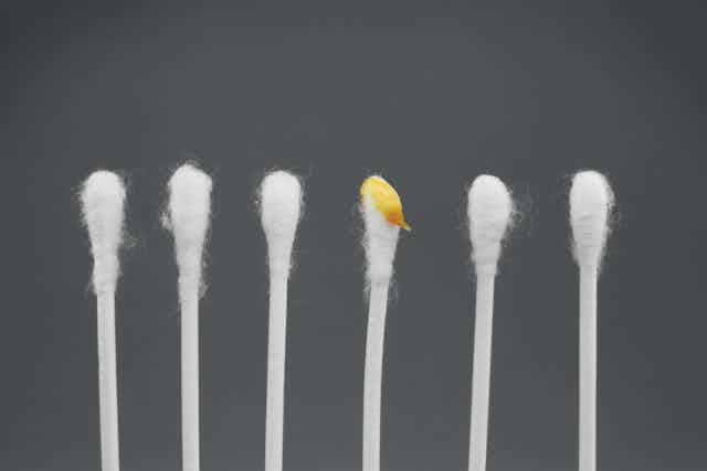 six cotton swabs, one with yellowish earwax on it