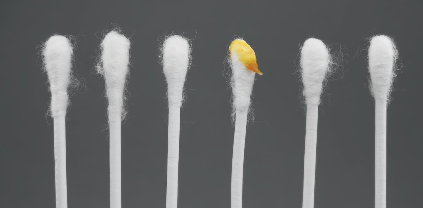 What is earwax?