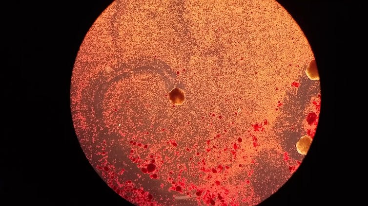 Photo prise au microscope ; au centre de l’image, un xénobot se déplace en laissant une trainée derrière lui