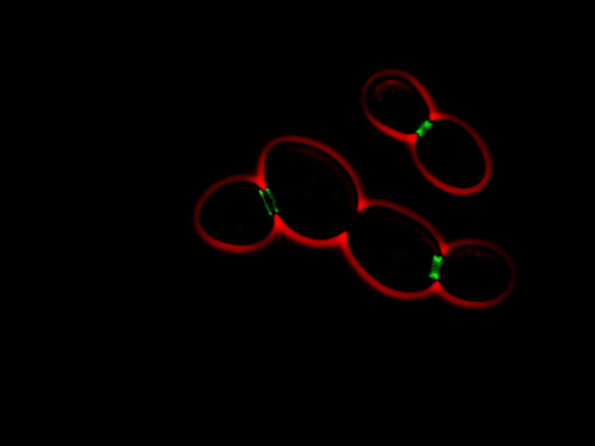 Des protéines de type « prion » impliquées dans la mémoire