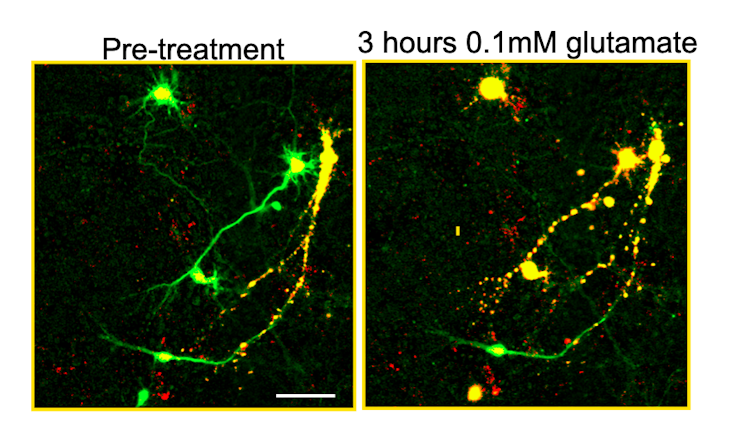 Microscopy images showing rat neurons before and after treatment with glutamate; the neurons are colored green when alive and yellow when dead