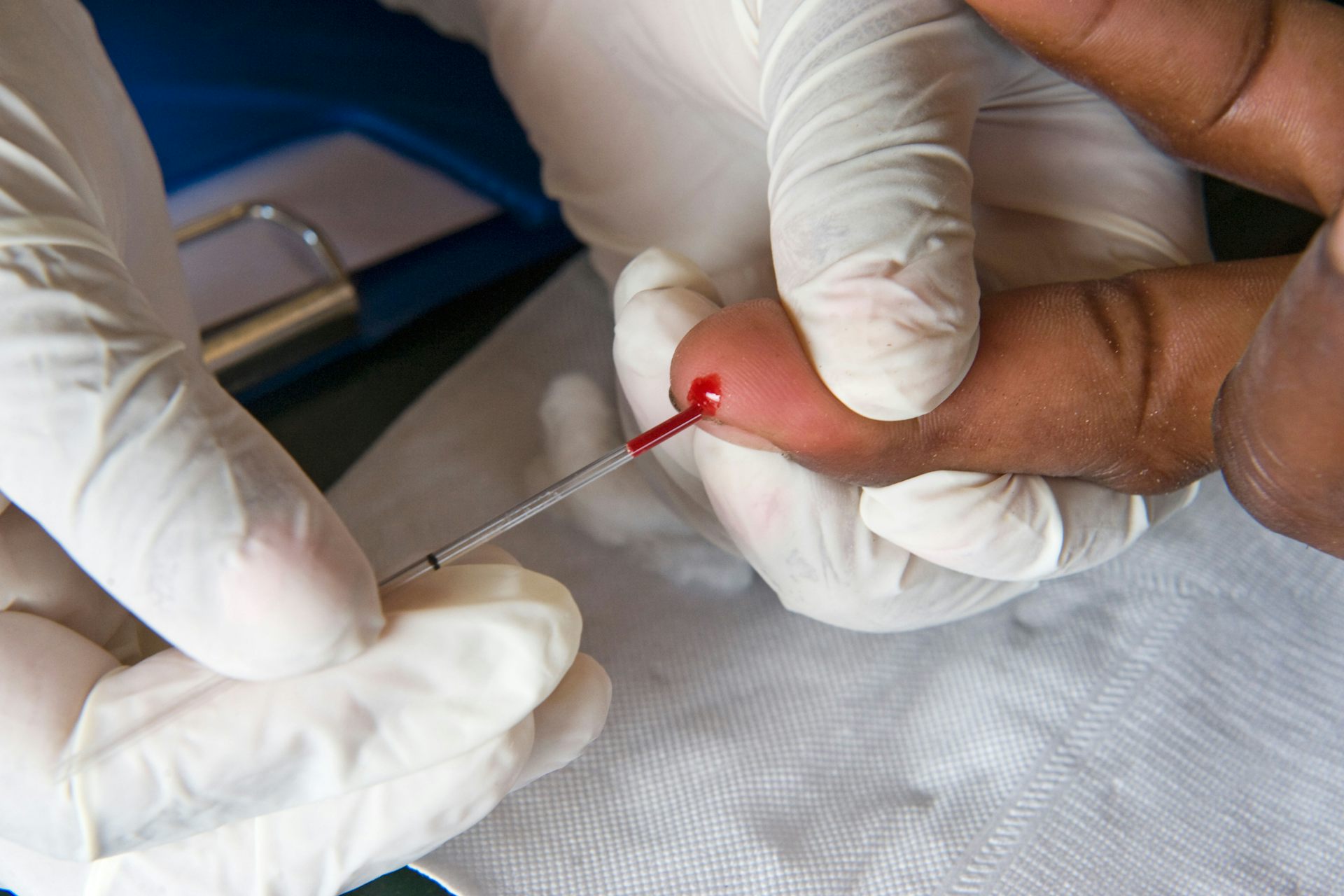 Cancer drug could help fight HIV – new research - The Conversation UK