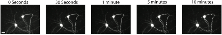 Time lapse of dying neuron over 10 minutes under a microscope