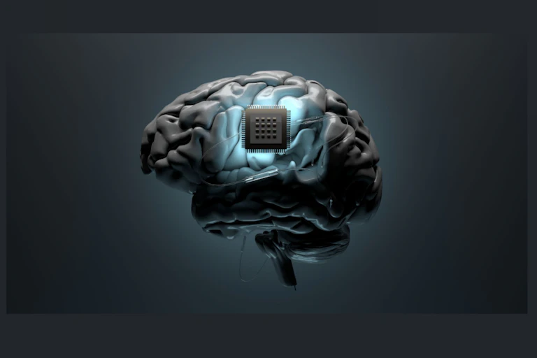 Cerebro con chip.