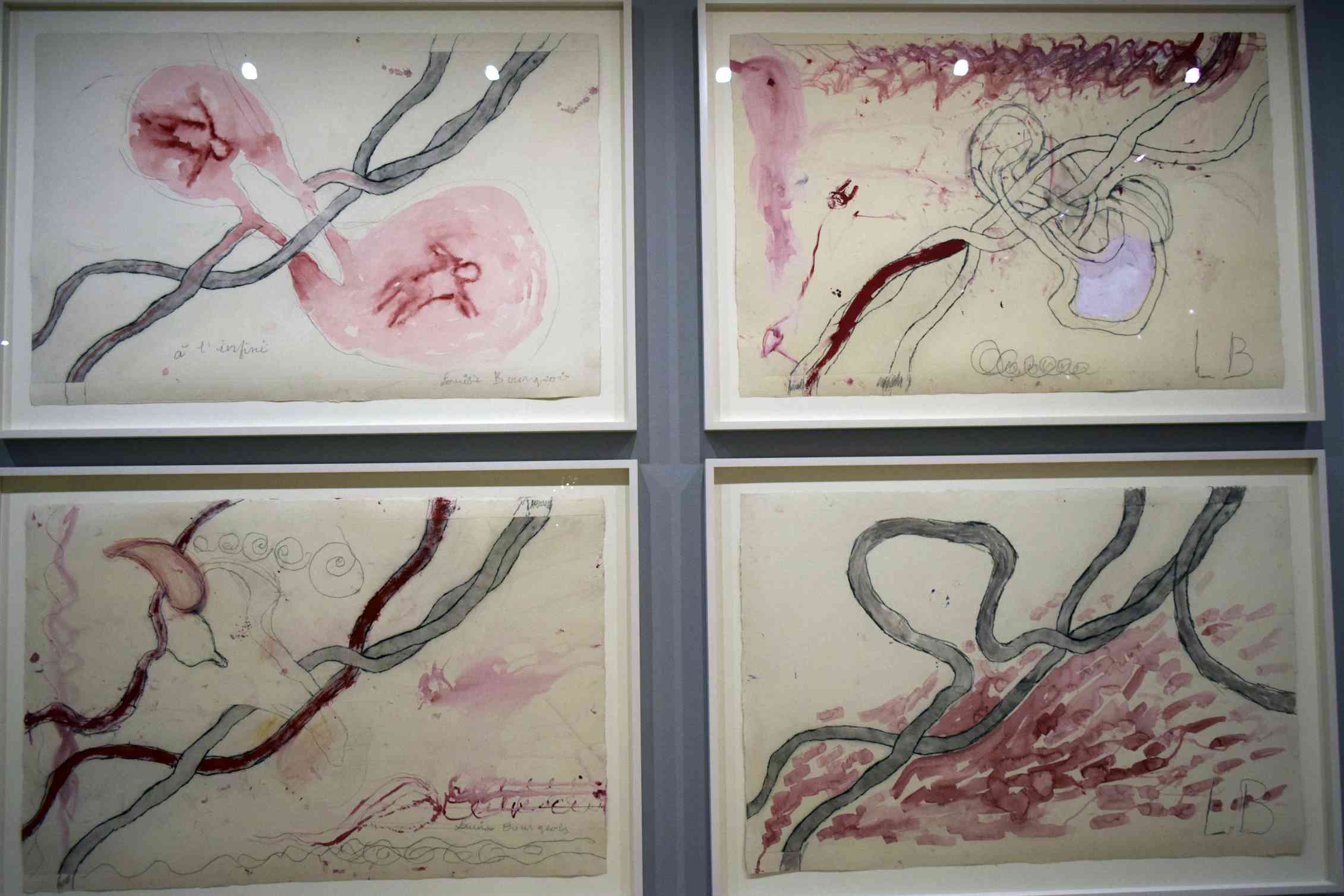 Images of the placenta and umbilical cord.