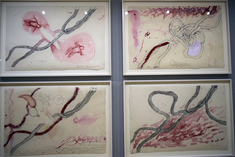 Images of the placenta and umbilical cord.