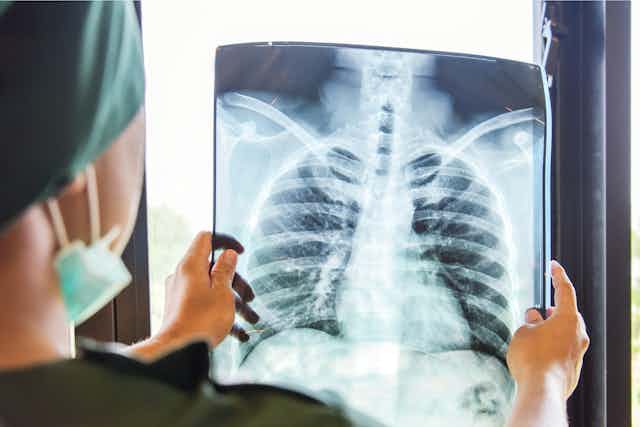 Una médico observando una radiografía de pulmones.
