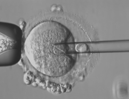 'Maeve's law' would let IVF parents access technology to prevent mitochondrial disease. Here's what the Senate is debating