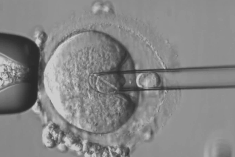 Close-up of cell with micro needle