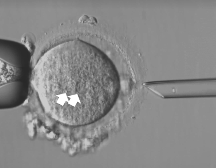 Zygote undergoing pronuclear transfer