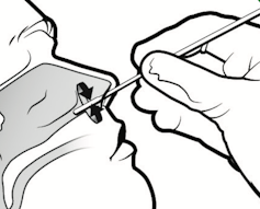 Correct sampling technique for nasal swab